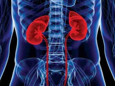 KIDNEY DISEASE