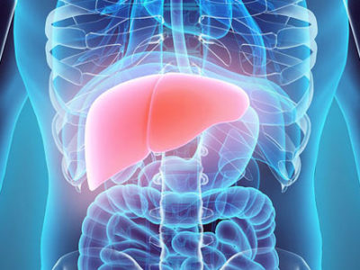 LIVER CIRRHOSIS DISEASE