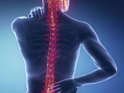 SPINAL-CORD-INJURIES