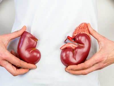 kidney disease